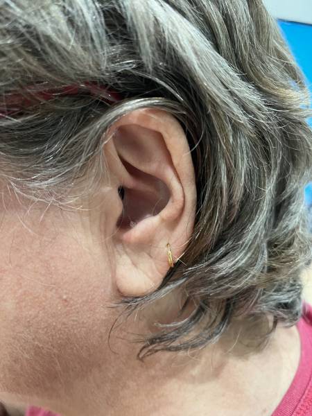 Appareil auditif porté par une patiente chez M & l'audition