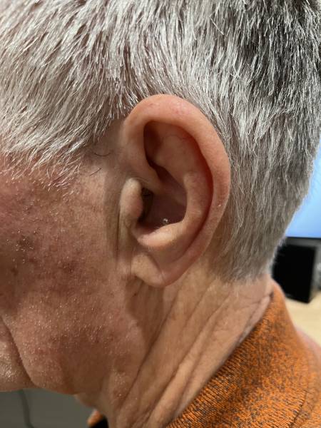 Appareil auditif porté par un patient